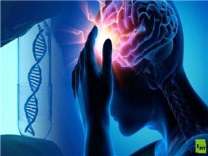 روسيا تبتکر دواء ثوريا لعلاج تلف الدماغ بعد الجلطات